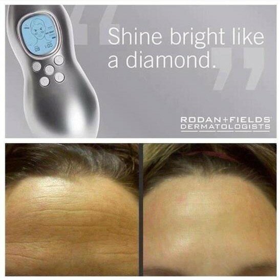 rodan and fields skincare