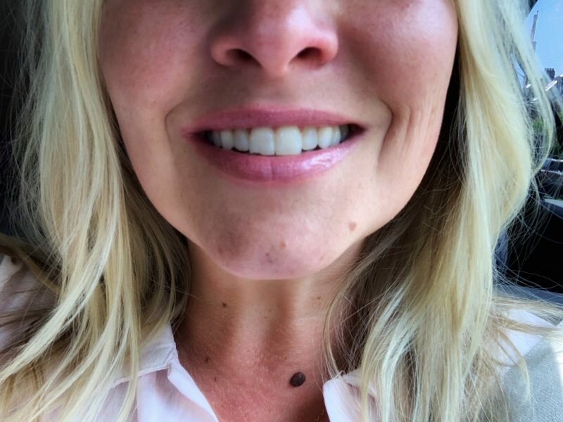 how a chipped tooth taught me to take time for myself